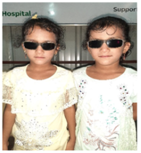 Die Zwillinge Rajia und Muni nach der Augenoperation mit Sonnenbrille