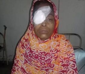Frau in Bangladesch nach Augenoperation mit Augenpflaster